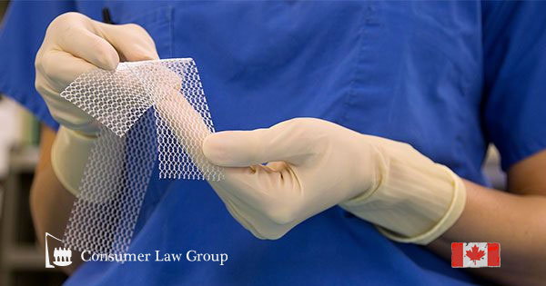 Hernia Mesh Complications Are Basis For Lawsuits Slater Zurz